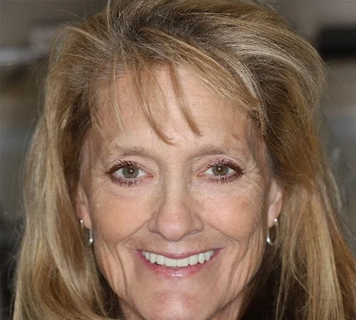 After: the same patient after treatment at Smile Arkansas.