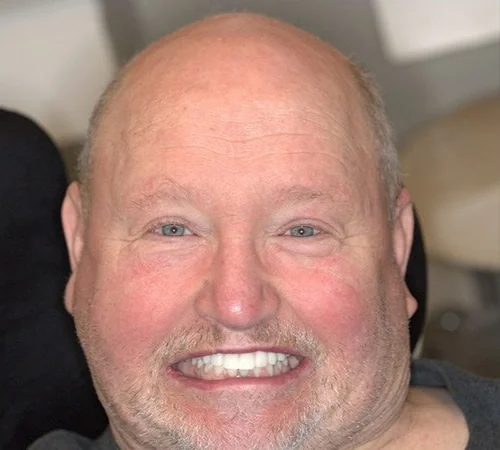 After: the same patient after treatment at Smile Arkansas.